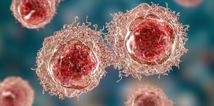 Přelomové: Vědci z Tel Avivské univerzity přiměli rakovinné buňky, aby „spáchaly sebevraždu“